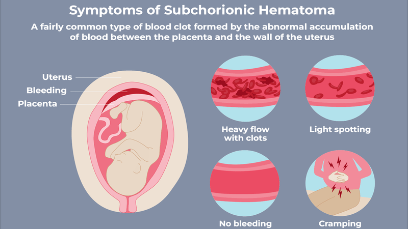 Tư thế nằm khi bị bóc tách - Mẹ bầu không thể bỏ qua! 1