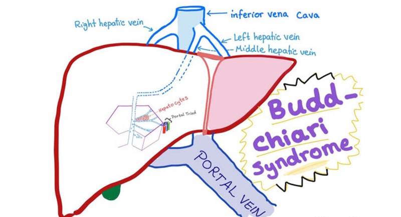 Tuần hoàn bàng hệ và phương pháp xác định hướng chảy của dòng máu trong tuần hoàn bàng hệ 3