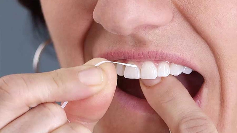 Túi nha chu là gì? Cách điều trị túi nha chu 4