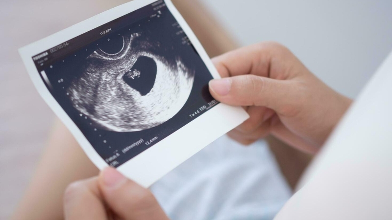 Túi thai 11mm chưa có phôi có sao không? Vì sao siêu âm thấy túi thai nhưng chưa có phôi? 1