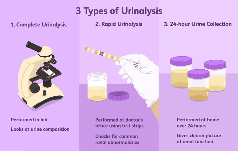 Túi thừa bàng quang là gì? Có nguy hiểm không? 2