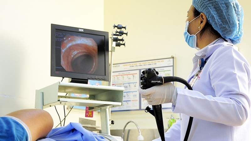 Túi thừa đại tràng: Nguyên nhân, triệu chứng và cách phòng ngừa 4