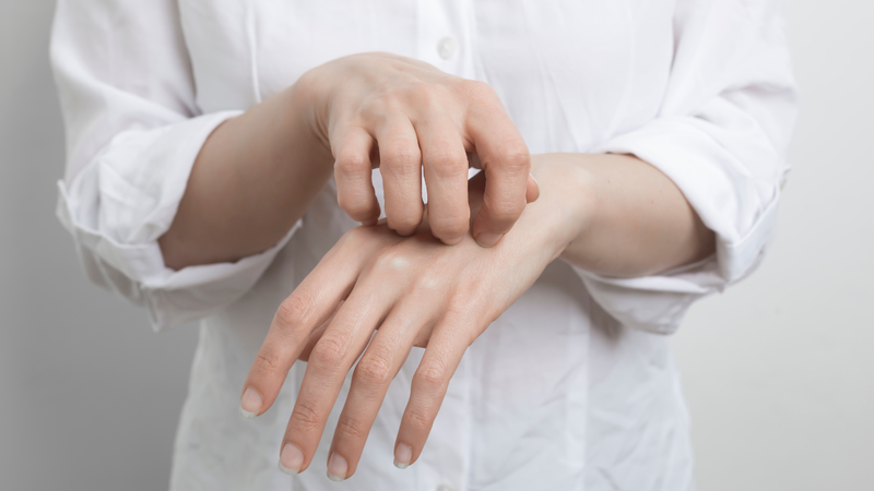 Tổn thương Tungiasis có nguy cơ nhiễm trùng thứ phát