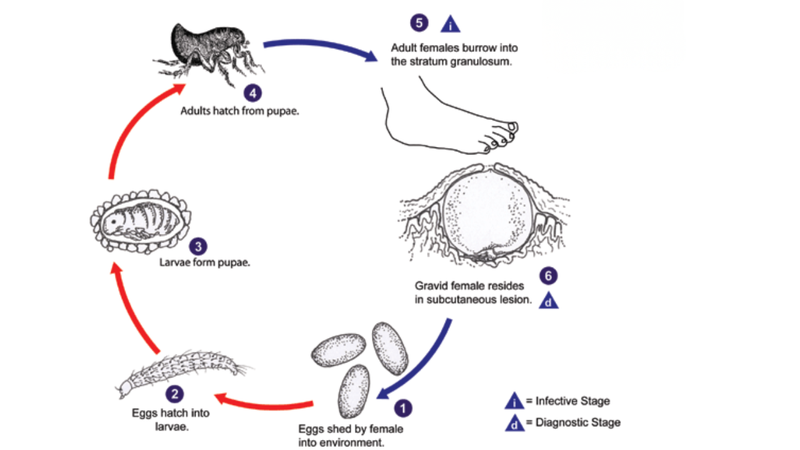 Bệnh Tungiasis xảy ra khi bọ chét cát cái (Tunga penetrans) xâm nhập vào da người