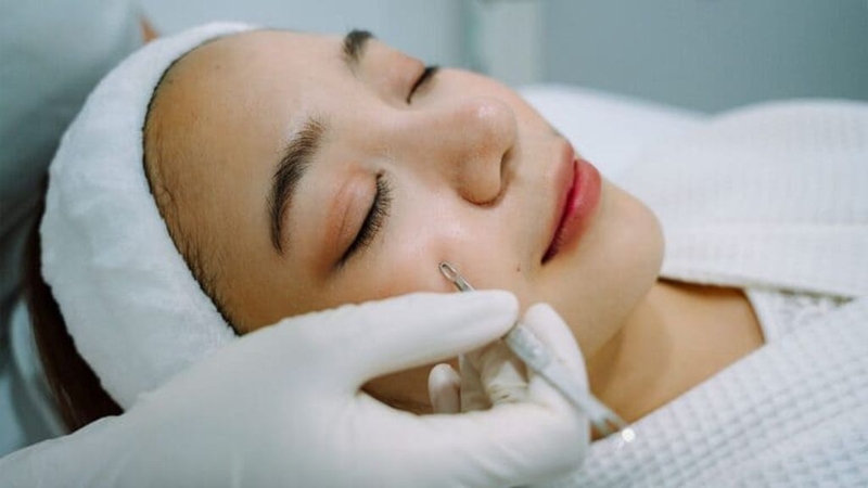 Tuổi dậy thì có nên đi spa nặn mụn không? 2