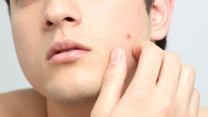 Tuổi dậy thì ở nam kéo dài bao lâu? Những thay đổi tâm sinh lý ở trẻ? 1