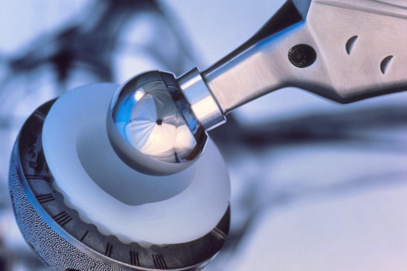 Tuổi thọ của khớp háng nhân tạo và những điều cần biết 2