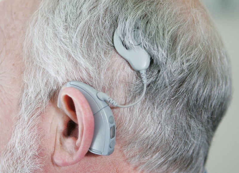 Tuổi thọ của ốc tai điện tử: Những yếu tố quyết định 2