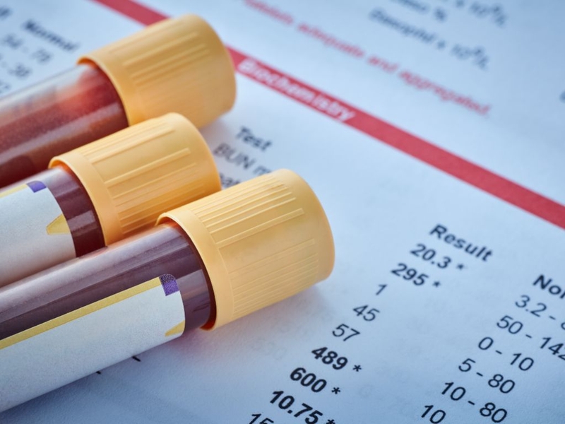 Tụt huyết áp: Nguyên nhân, chẩn đoán, điều trị và biện pháp phòng ngừa 4