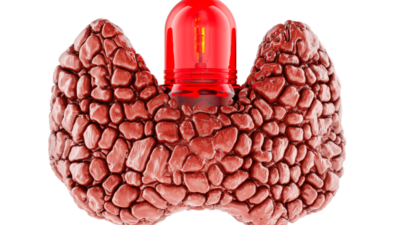 Tuyến giáp có nhân hỗn hợp âm một khối nhân có cấu trúc gồm cả phần đặc và phần chứa dịch (nang)