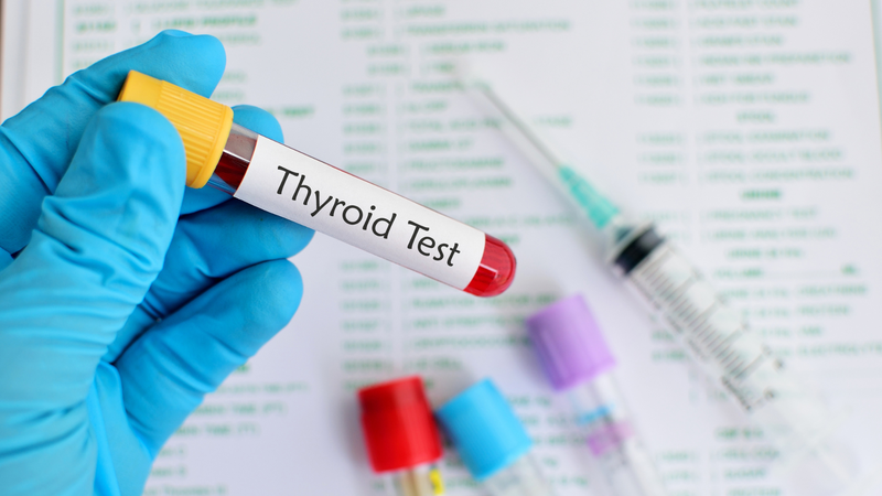 Xét nghiệm hormone tuyến giáp để chẩn đoán bệnh lý tuyến giáp