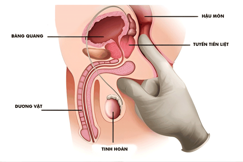 Tuyến tiền liệt nằm ở đâu? Biểu hiện nào cần đi bác sĩ?