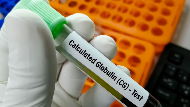 Tỷ lệ Albumin/Globulin trong xét nghiệm sinh hóa máu