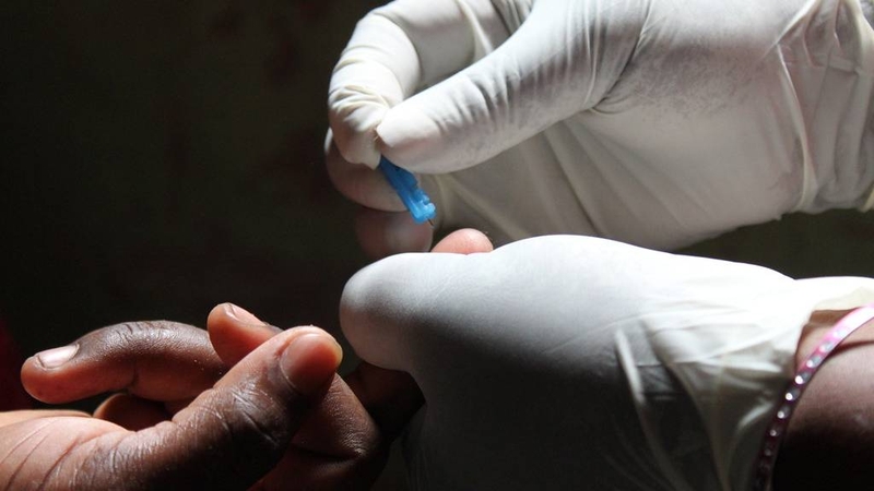 Tỷ lệ nhiễm HIV qua đường miệng cùng các biện pháp phòng tránh an toàn 5