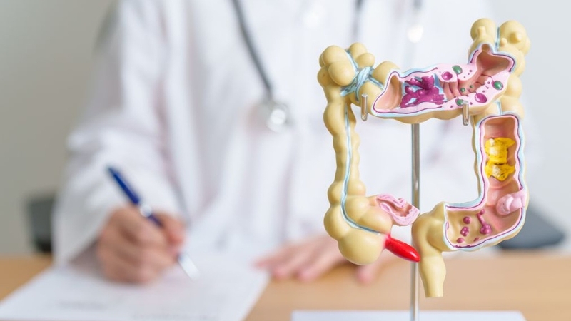 Tỷ lệ sống sót đối với bệnh ung thư đại trực tràng 3