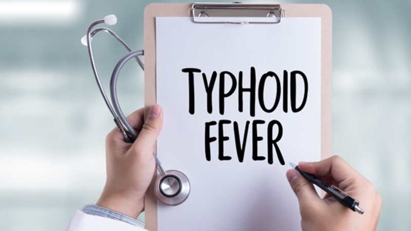 Typhoid fever là gì? Những thông tin cơ bản về Typhoid fever không phải ai cũng biết