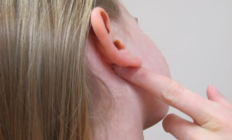 U bã đậu xuất hiện nhiều nhất ở vùng da tiết nhiều mồ hôi dầu