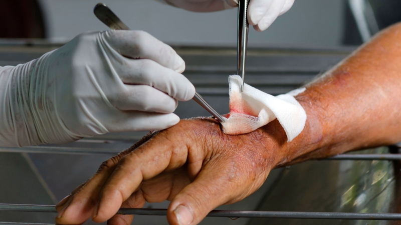 Chăm sóc vết thương sau phẫu thuật cẩn thận để tránh nhiễm trùng