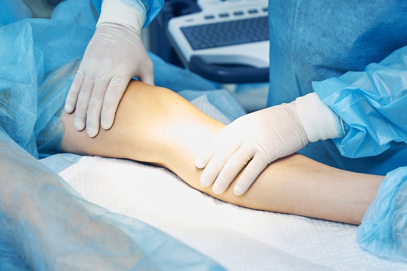 U bao hoạt dịch khoeo chân là gì? Nguyên nhân và cách điều trị 4