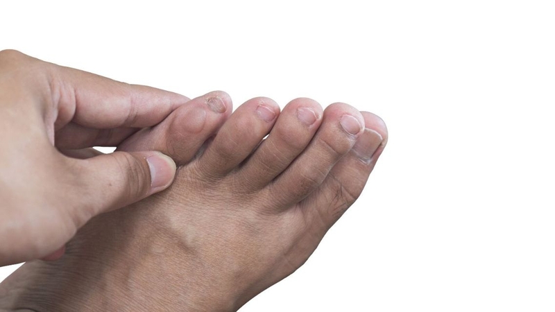 U bướu ở ngón chân có thể xuất phát từ nhiều nguyên nhân khác nhau