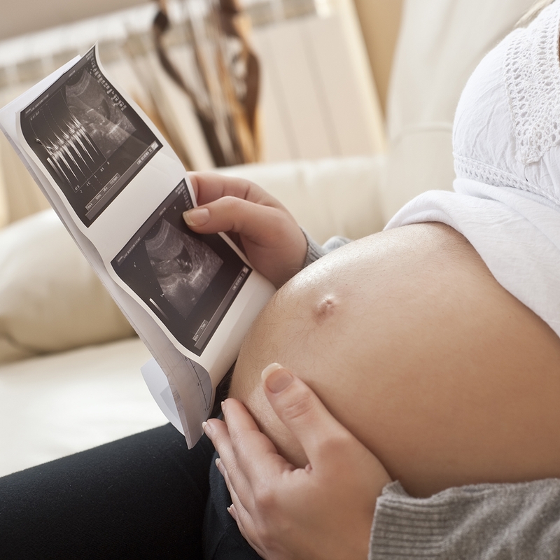 U cơ tim thai nhi có ảnh hưởng đến trẻ sau sinh? Cùng tìm hiểu về u cơ tim thai nhi3