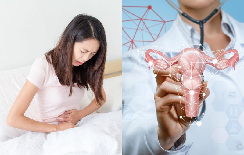 Ứ dịch lòng tử cung là gì? Nguyên nhân và dấu hiệu nhận biết tình trạng ứ dịch lòng tử cung 3