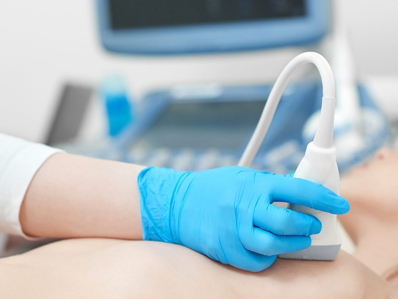 U diệp thể tuyến vú là gì chẩn đoán ra sao 3