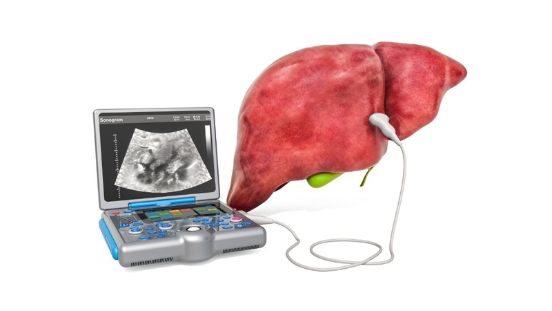 U gan lành tính thường được phát hiện qua siêu âm hoặc chụp CT, MRI