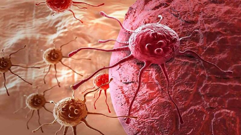 U lành tính có tăng sinh mạch máu không? Điều trị tăng sinh mạch máu trong ung thư 1