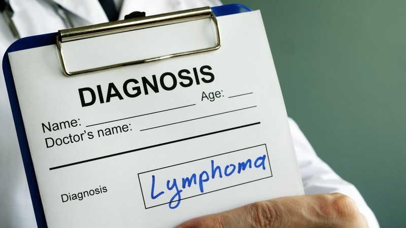 U lympho lành tính: Có cần lo lắng? Góc nhìn từ bác sĩ chuyên khoa 2