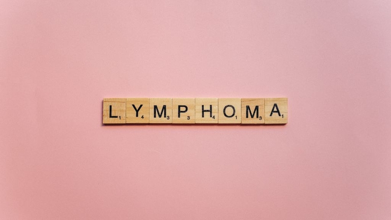 U lympho lành tính: Có cần lo lắng? Góc nhìn từ bác sĩ chuyên khoa 3