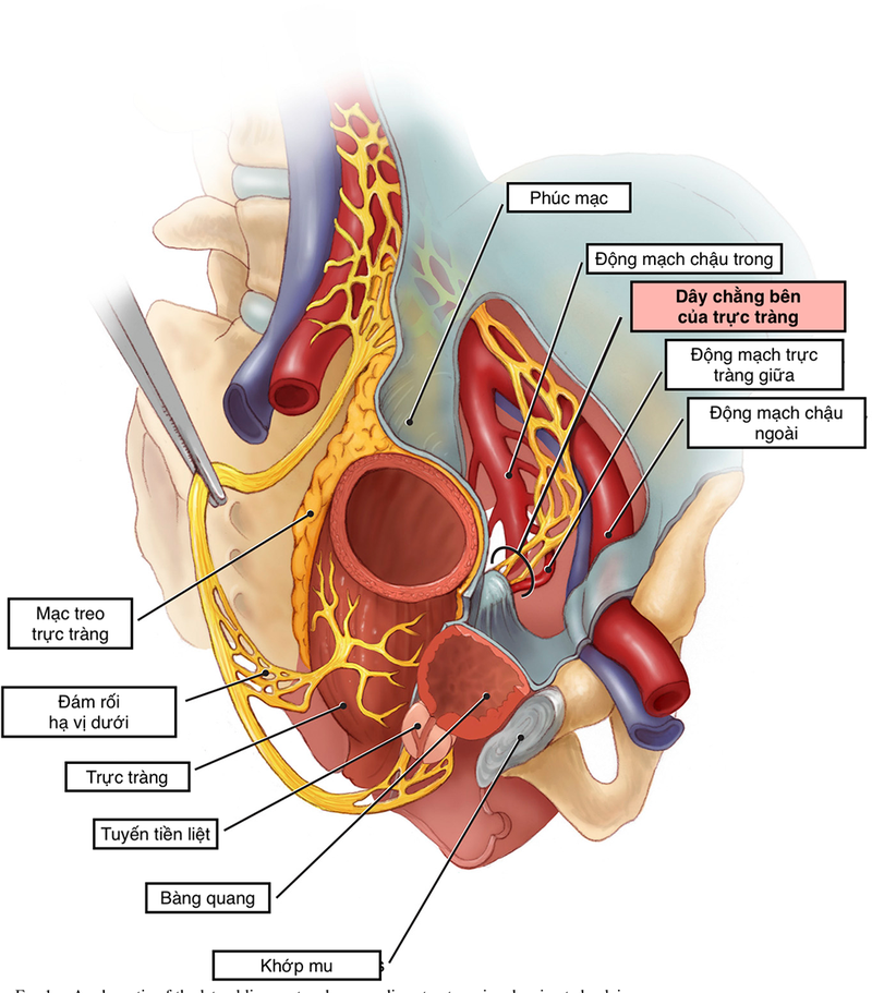 U mạc treo ruột có nguy hiểm không? Phương pháp điều trị 2
