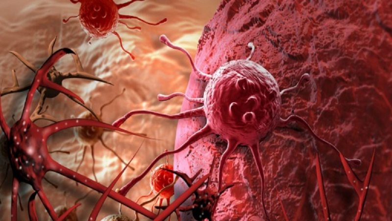 U máu gan: Nguyên nhân, triệu chứng và phương pháp điều trị 2