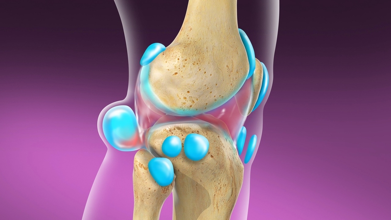 U nang bao hoạt dịch khớp gối chữa bằng cách nào? 1