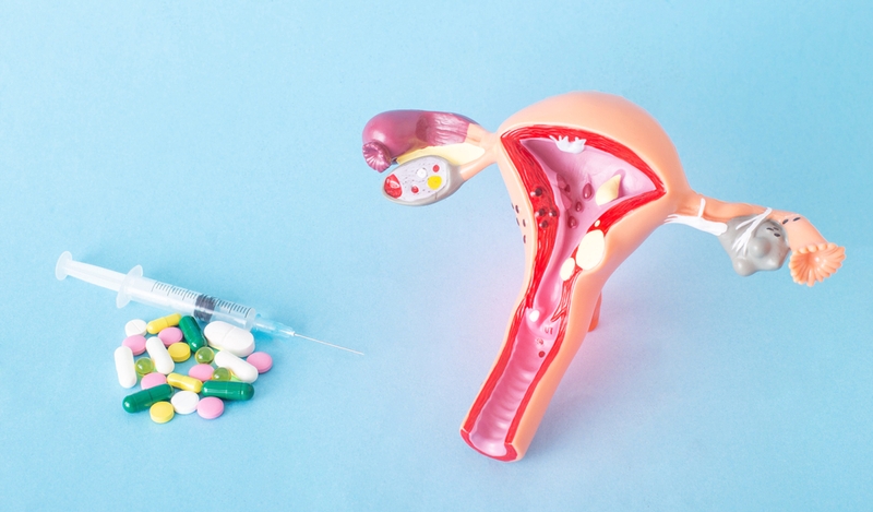 u nang buồng trứng lạc nội mạc tử cung 3