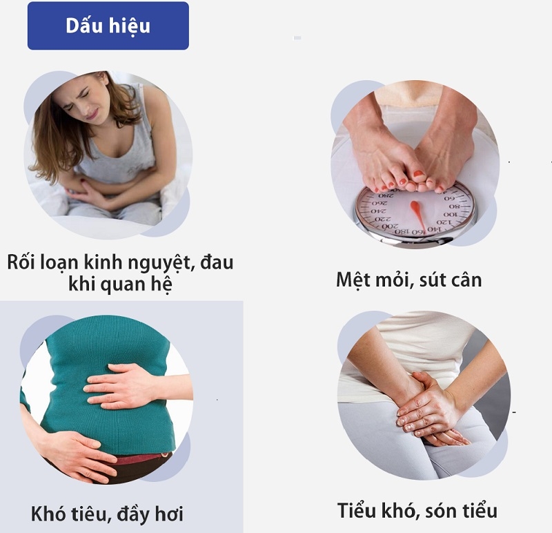 Tổng quan u nang buồng trứng trái 4