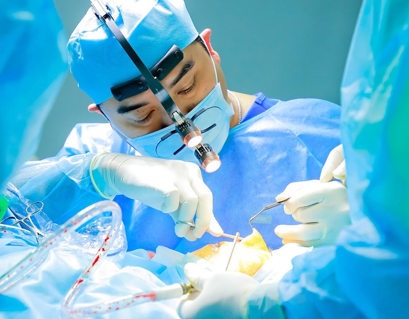 U nang sàn mũi và phương pháp phẫu thuật cắt u nang sàn mũi 3