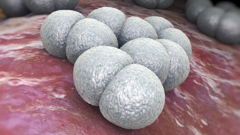 U nang tuyến Bartholin 3