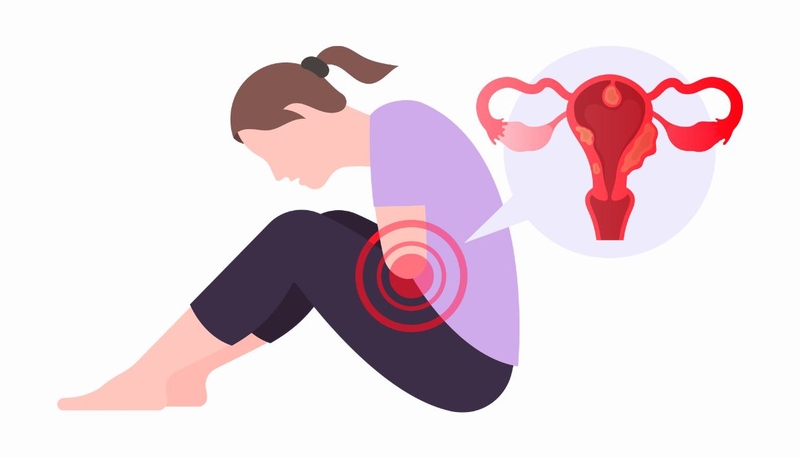 U nang và u xơ: Có gì khác biệt giữa hai loại u này 1