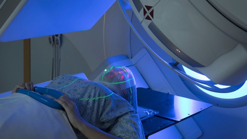 U não di căn có những biểu hiện gì? Sống được bao lâu? 3