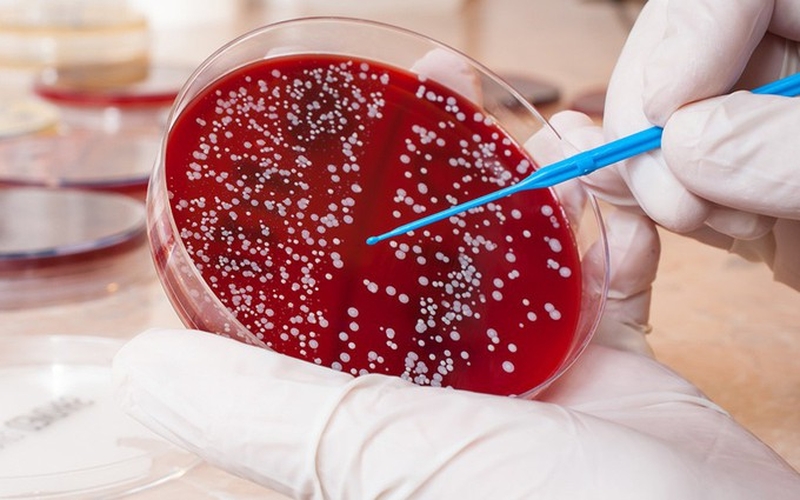 U nguyên bào thần kinh ở trẻ em có điều trị được không? 4