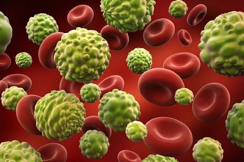 U nguyên bào thần kinh – Trẻ em: Những yếu tố nguy cơ 3