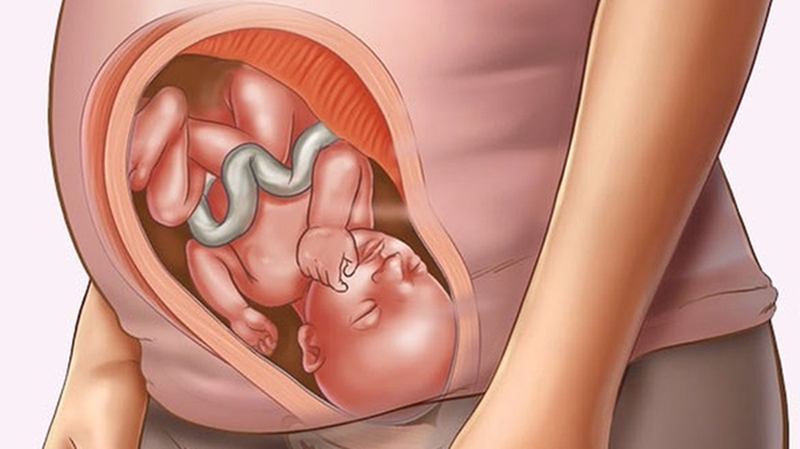 U sắc tố bẩm sinh ở trẻ em: Nguyên nhân, triệu chứng và cách điều trị 4