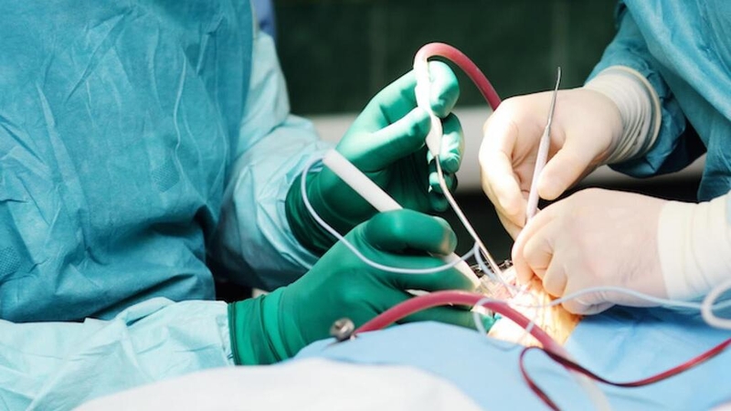 U schwannoma: Nguyên nhân, triệu chứng, chẩn đoán và phương pháp điều trị 4