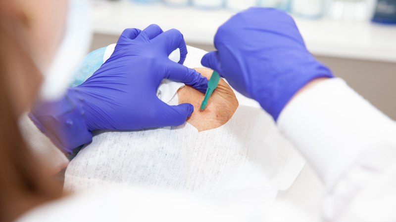 Sinh thiết là bước quyết định trong chẩn đoán, giúp bác sĩ đưa ra hướng điều trị phù hợp và hiệu quả nhất