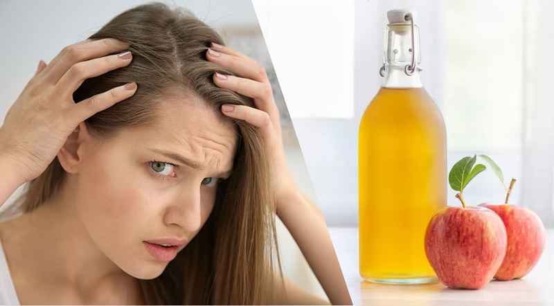 Ủ tóc trị gàu và dưỡng tóc bằng giấm táo