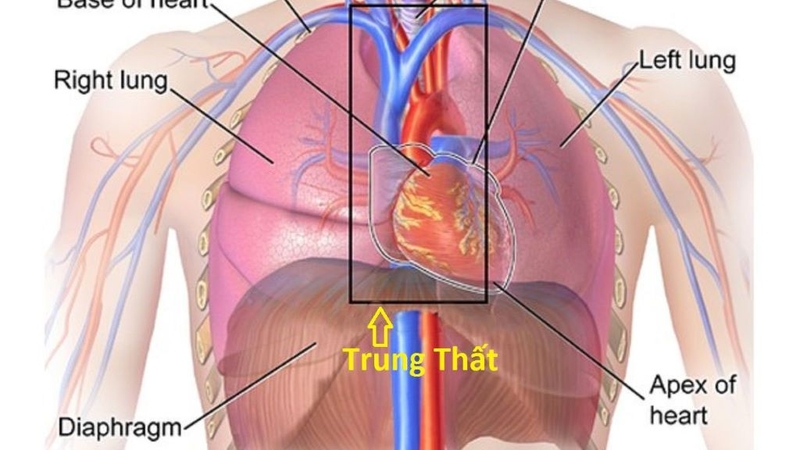 U trung thất có nguy hiểm không? Biểu hiện lâm sàng và cận lâm sàng chẩn đoán u trung thất 1