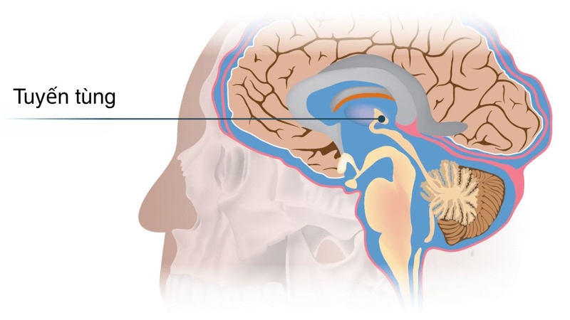 Hiểu rõ về u tuyến tùng ở trẻ em: Những điều cha mẹ cần biết 1