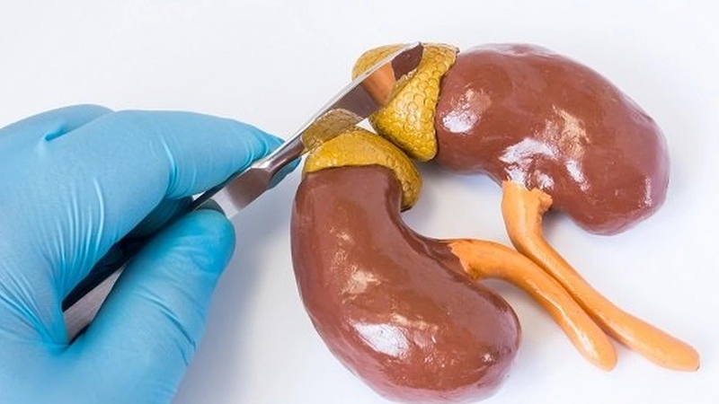 U tuyến thượng thận: Phân loại, nguyên nhân và các cách điều trị 1