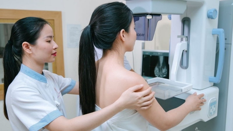 U vú lành tính có nên mổ không? Khi nào cần can thiệp phẫu thuật? 1